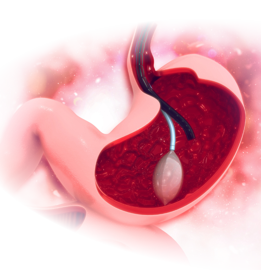 Endoscopía digestiva